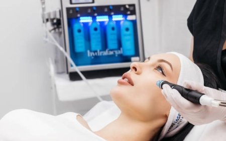 What to Look for in a Laser Hair Removal Equipment Supplier for Reliable Long-Term Support