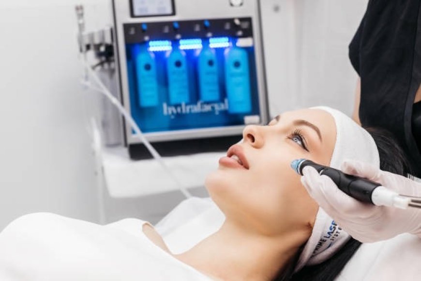 What to Look for in a Laser Hair Removal Equipment Supplier for Reliable Long-Term Support