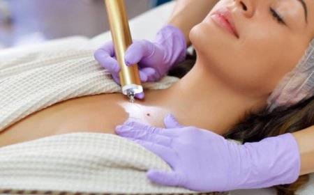 Skin Cancer Clinic or GP: What You Should Know