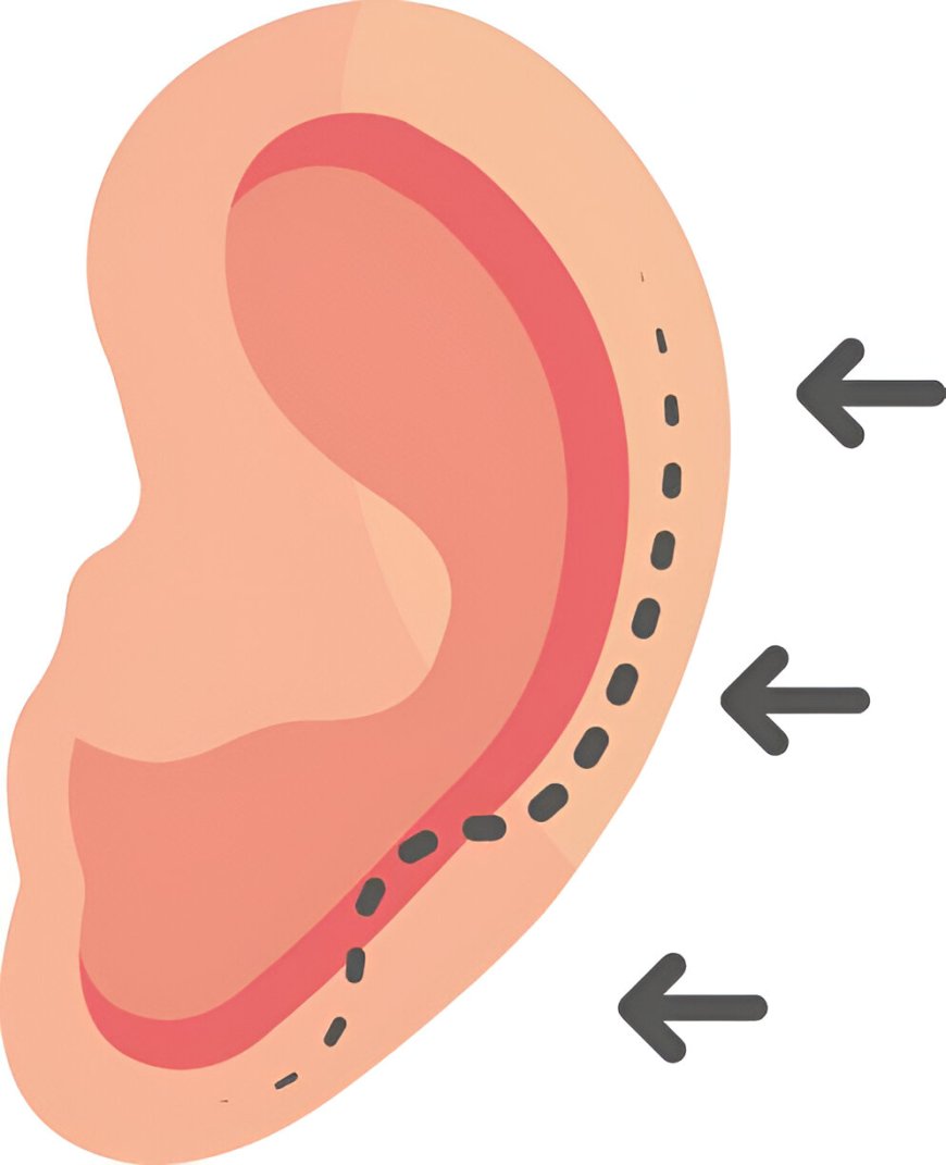 Get Your Ear Lobe Repair Today and Restore a Natural Look