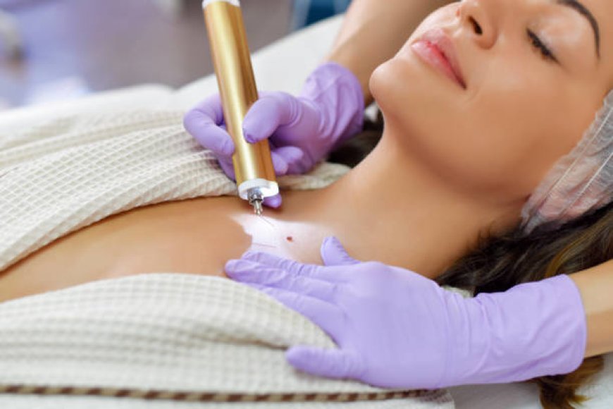 Skin Cancer Clinic or GP: What You Should Know