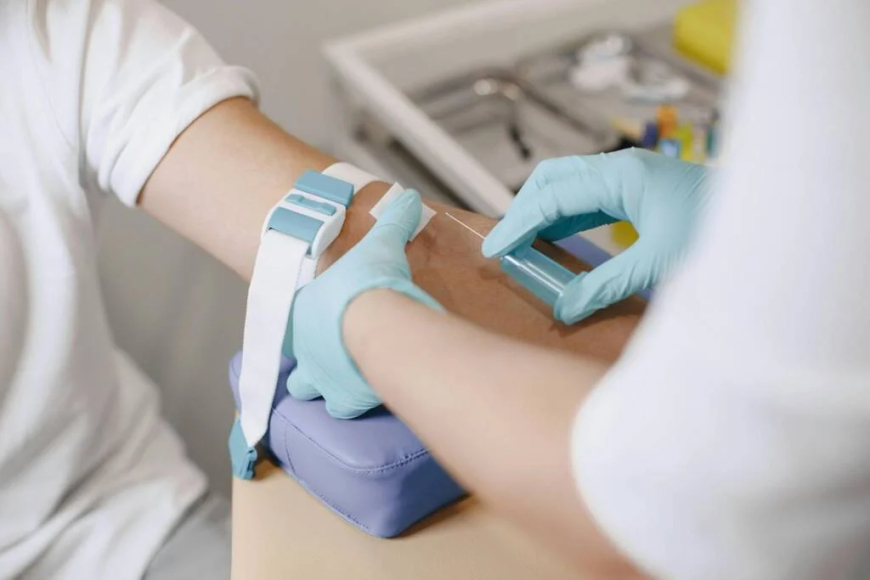 Why Doctors Monitor TB Quantiferon and FT3 Levels